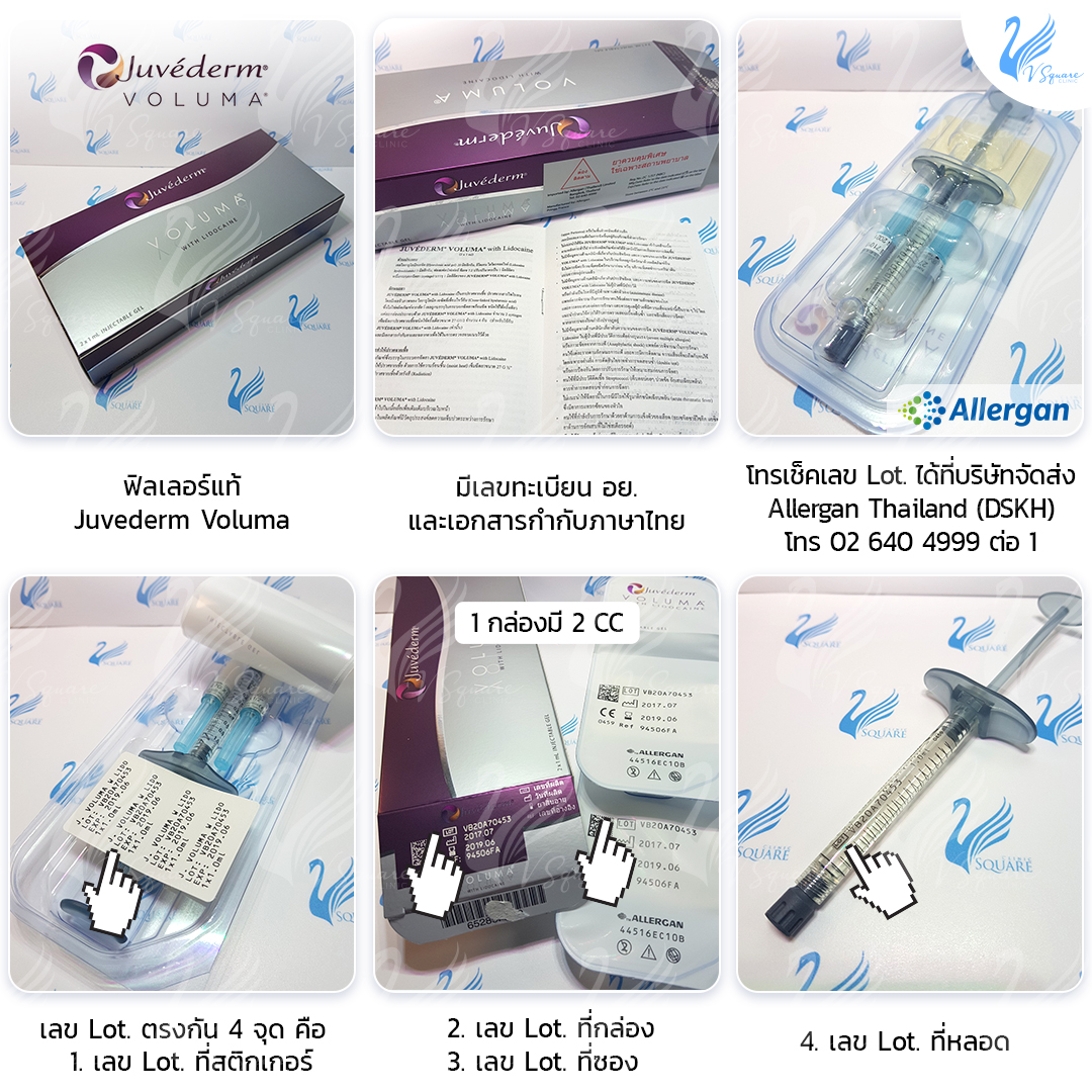 Juvederm Voluma