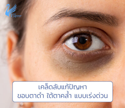 ขอบตาดํา