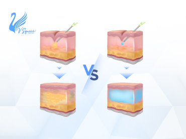 ฉีดไขมันใต้ตา-VS-ฉีดฟิลเลอร์ใต้ตา370x277