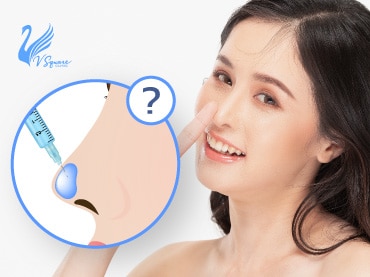 ฉีดฟิลเลอร์จมูก