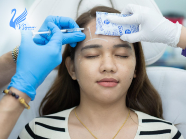 ฉีดโบท็อก370X277