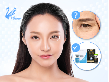 ฉีดโบท็อกซ์ยกหางตา-ไม่ต้องผ่าตัด-370x277