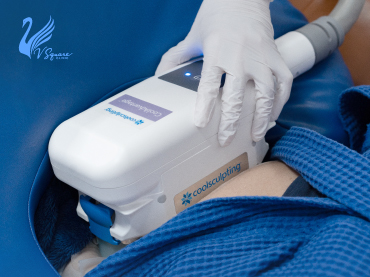 Coolsculpting