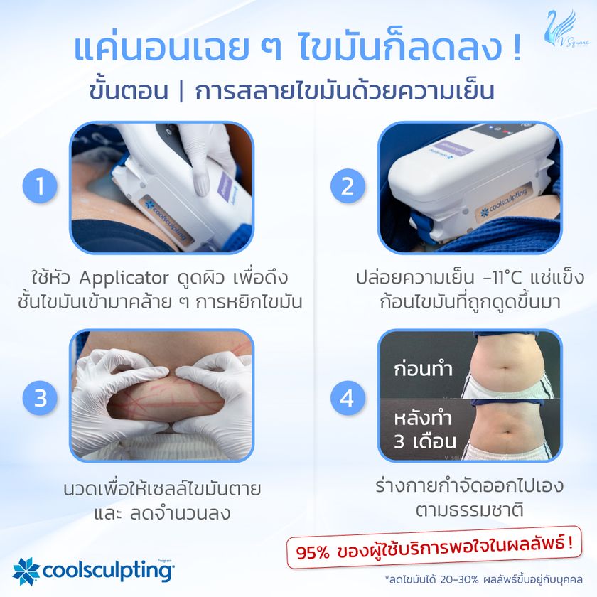 ทำ Coolsculpting เจ็บไหม
