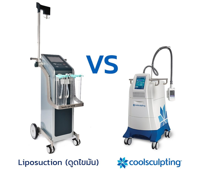 เปรียบเทียบการดูดไขมันและ Coolsculpting