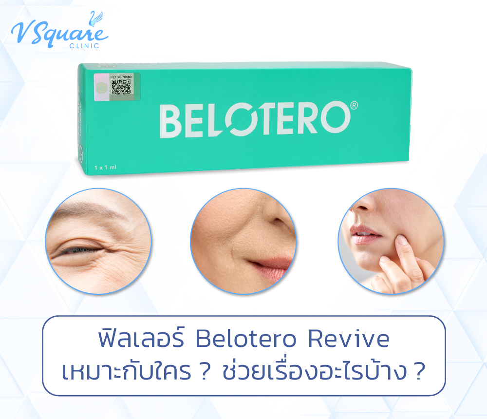 Belotero Revive