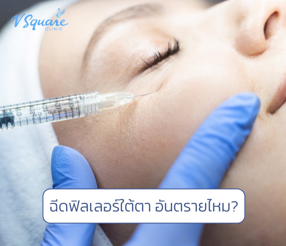 ฉีดฟิลเลอร์ใต้ตา อันตรายไหม