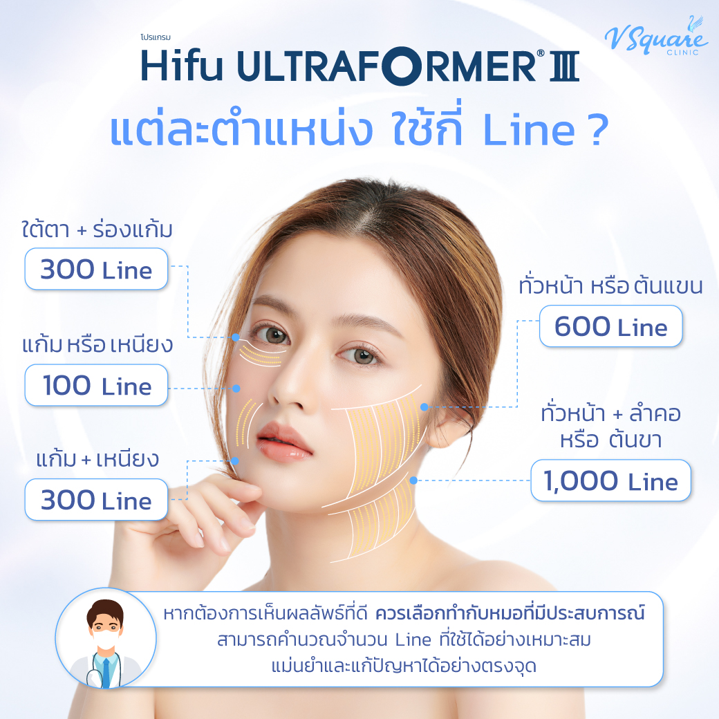 ทำ Hifu แต่ละตำแหน่งต้องใช้กี่ Line