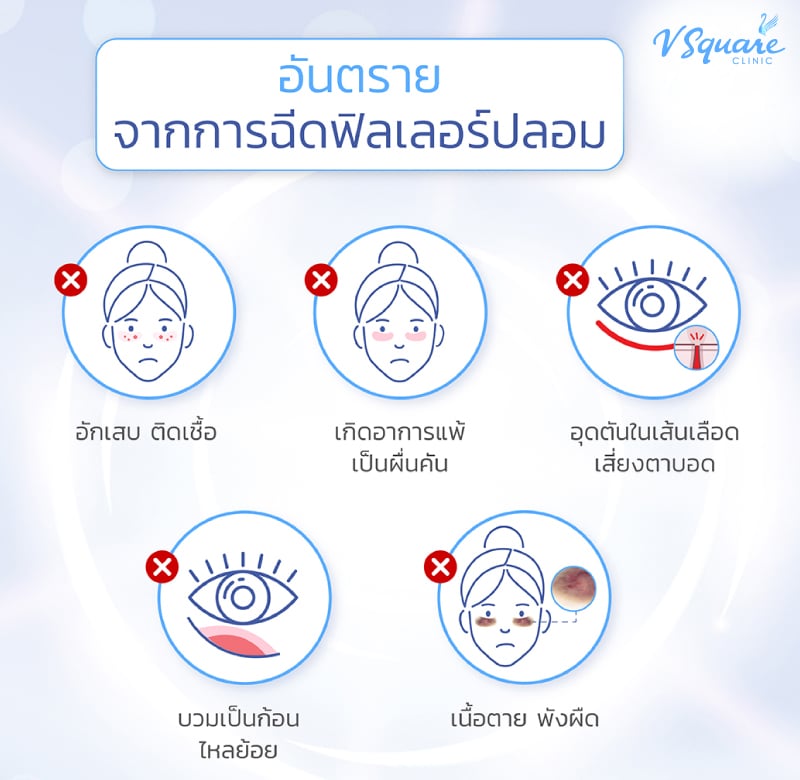 ผลข้างเคียงจากการฉีดฟิลเลอร์ปลอม