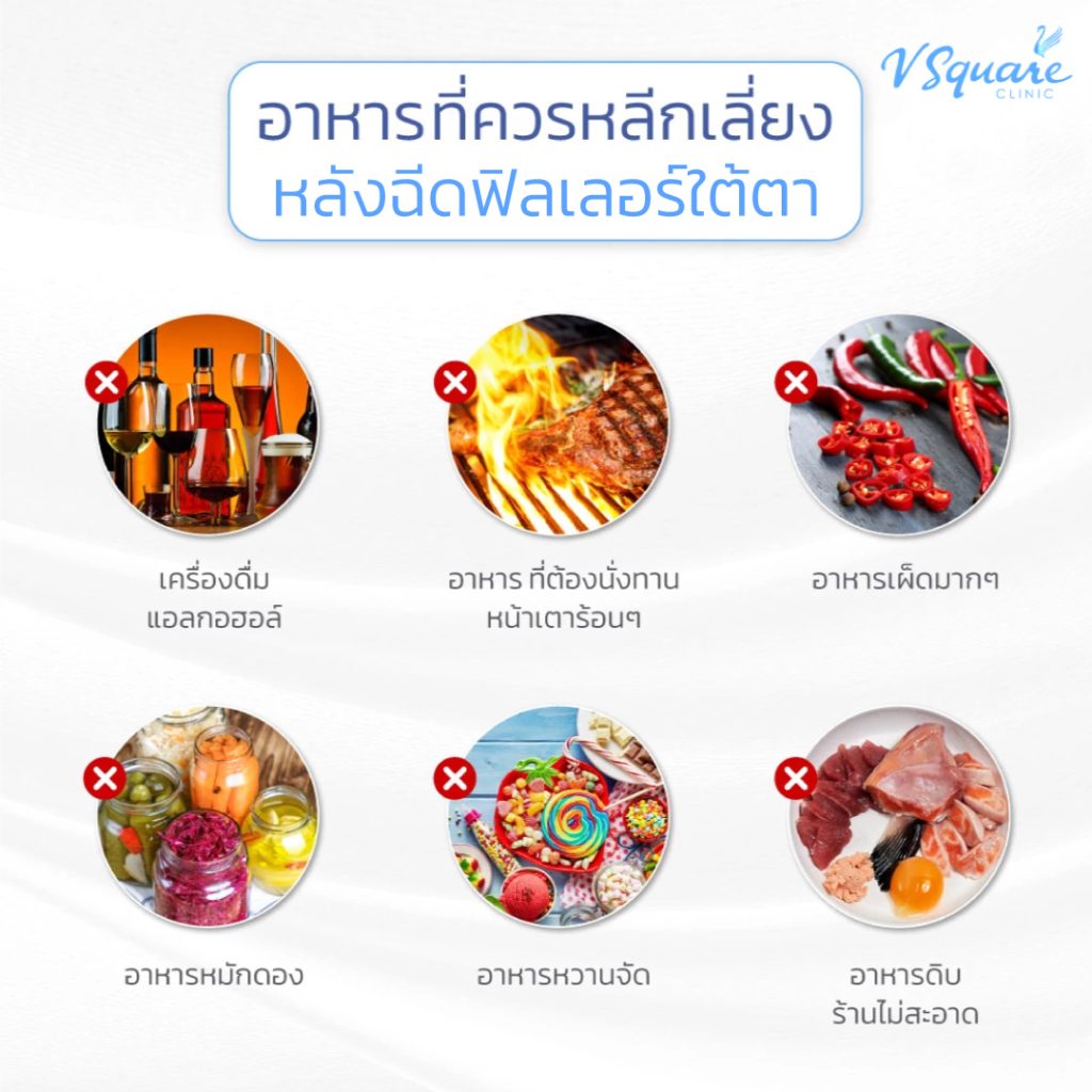 อาหารที่ควรเลี่ยงหลังฉีดใต้ตา