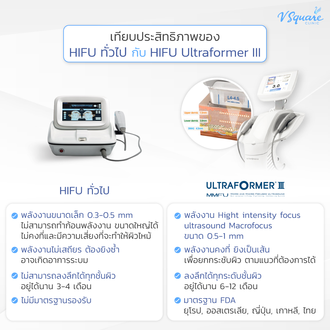 เปรียบเทียบ Hifu ธรรมดา กับ Ultraformer