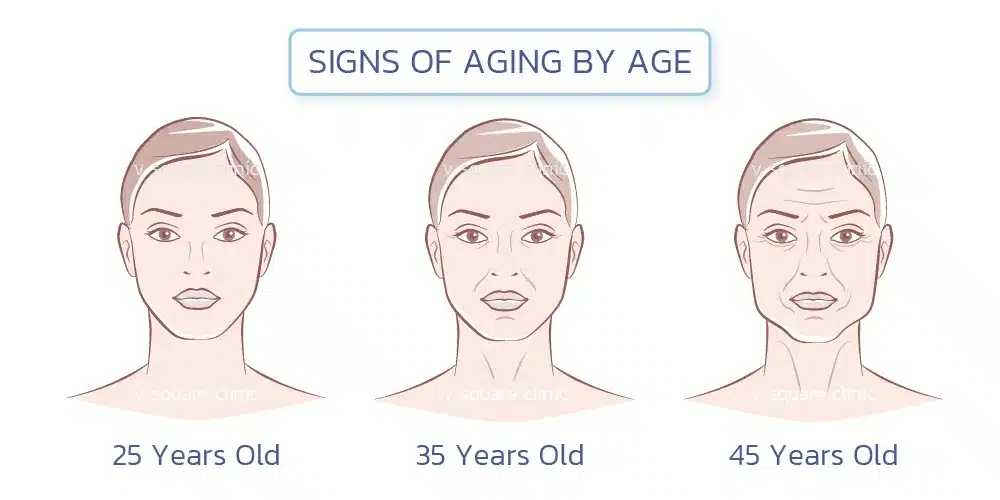 อายุที่มากขึ้นทำให้ผิวหย่อนคล้อย