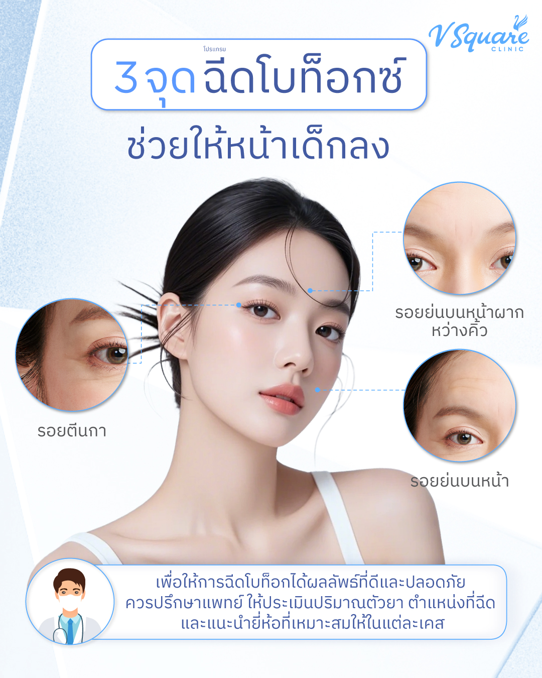 ตำแหน่งฉีดโบท็อก