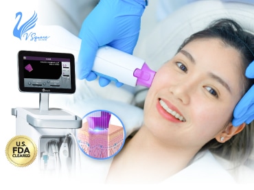 Thermage FLX
