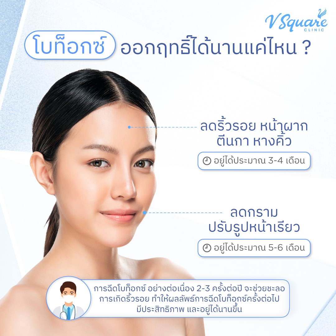 โบท็อกซ์ออกฤทธิ์ได้นานแค่ไหน