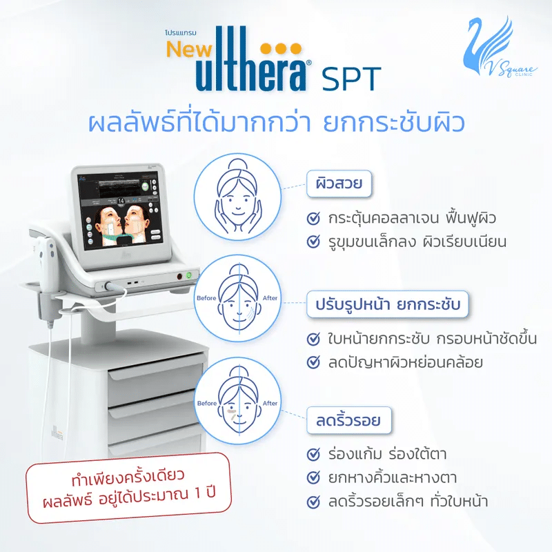 Ulthera ราคา คุ้มกับผลลัพธ์ที่ได้ไหม