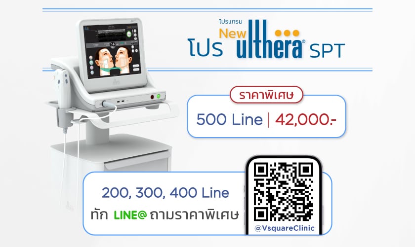 โปร Ultherapy SPT