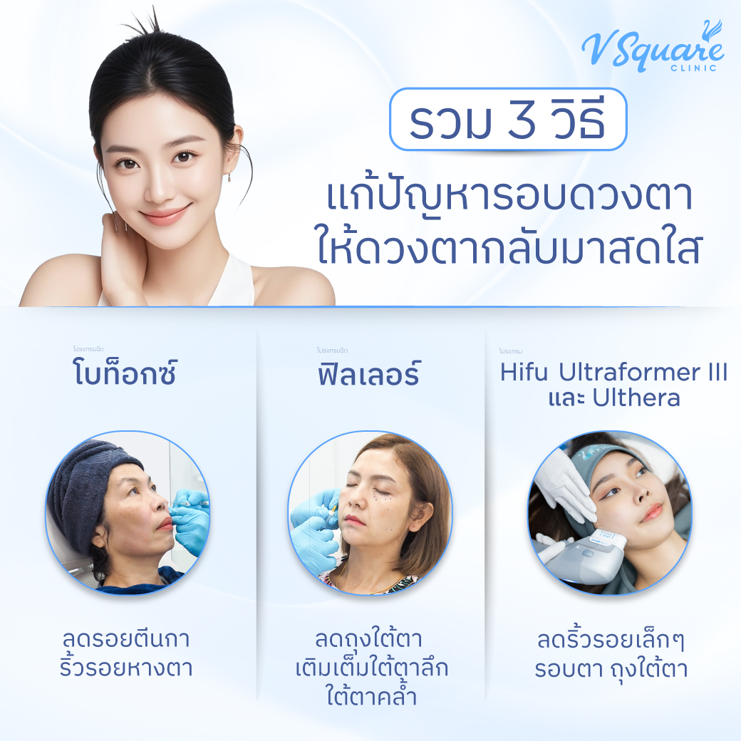 ริ้วรอยรอบดวงตา