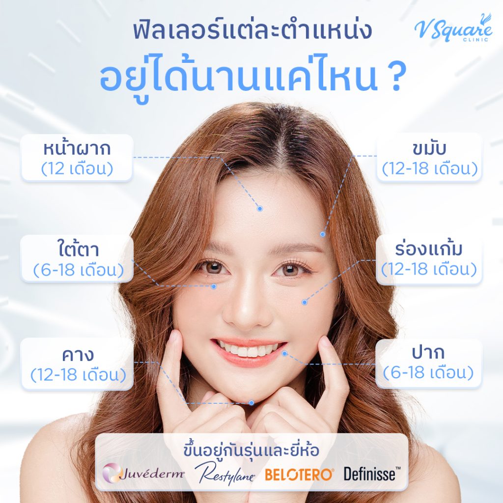 ฉีดฟิลเลอร์ อยู่ได้นานแค่ไหน