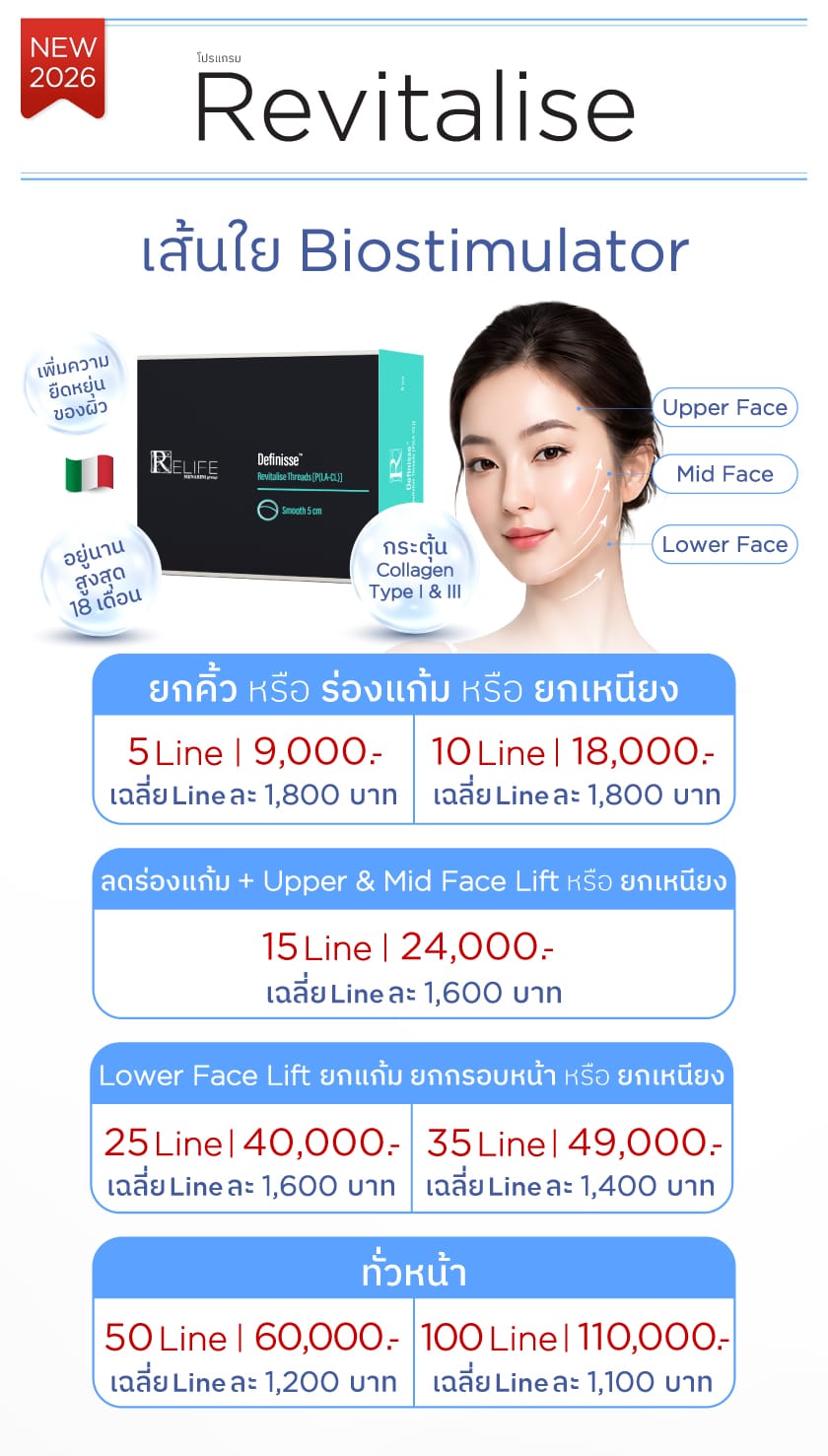 โปร Revitalise